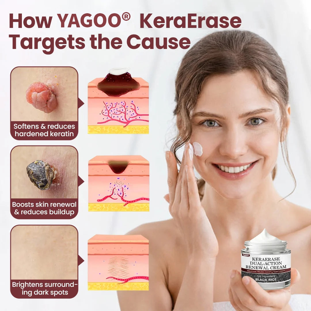 YAGOO® KeraErase Dual-Action Renewal Cream